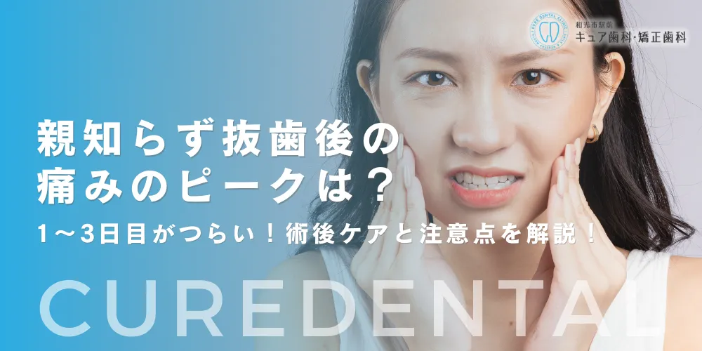 親知らず抜歯後の痛みのピークは？1～3日目がつらい！術後ケアと注意点を解説！