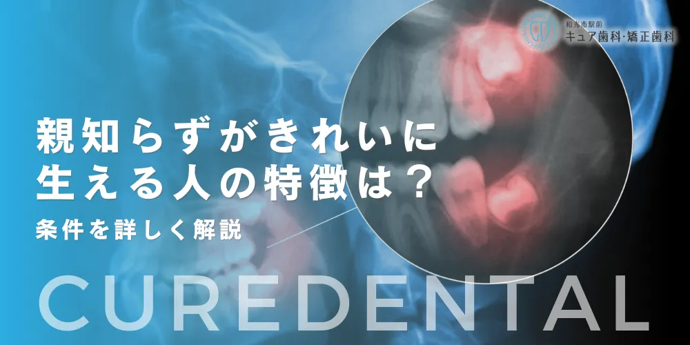 親知らずがきれいに生える人の特徴とは？条件を詳しく解説